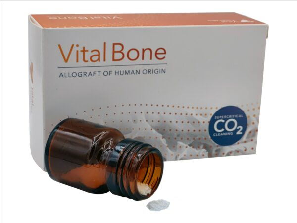 Vital Bone Cortical Chips 2cc (0,25-1mm)